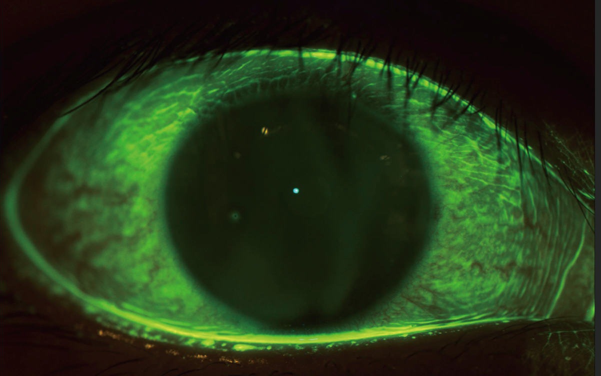 Corneal Topographer DEA520_20230607-19.png