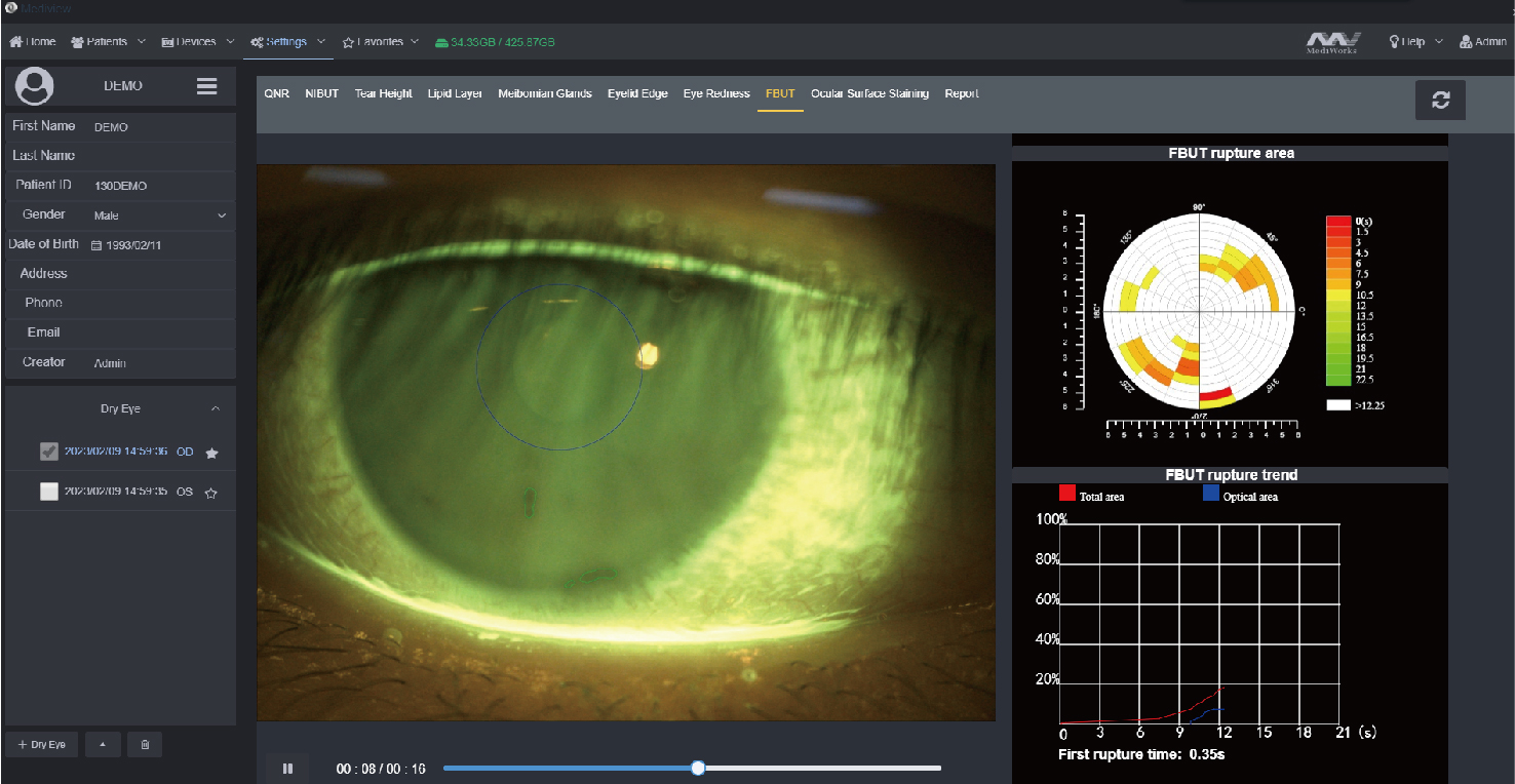 Dry eye diagnostic system_20230612-14.jpg