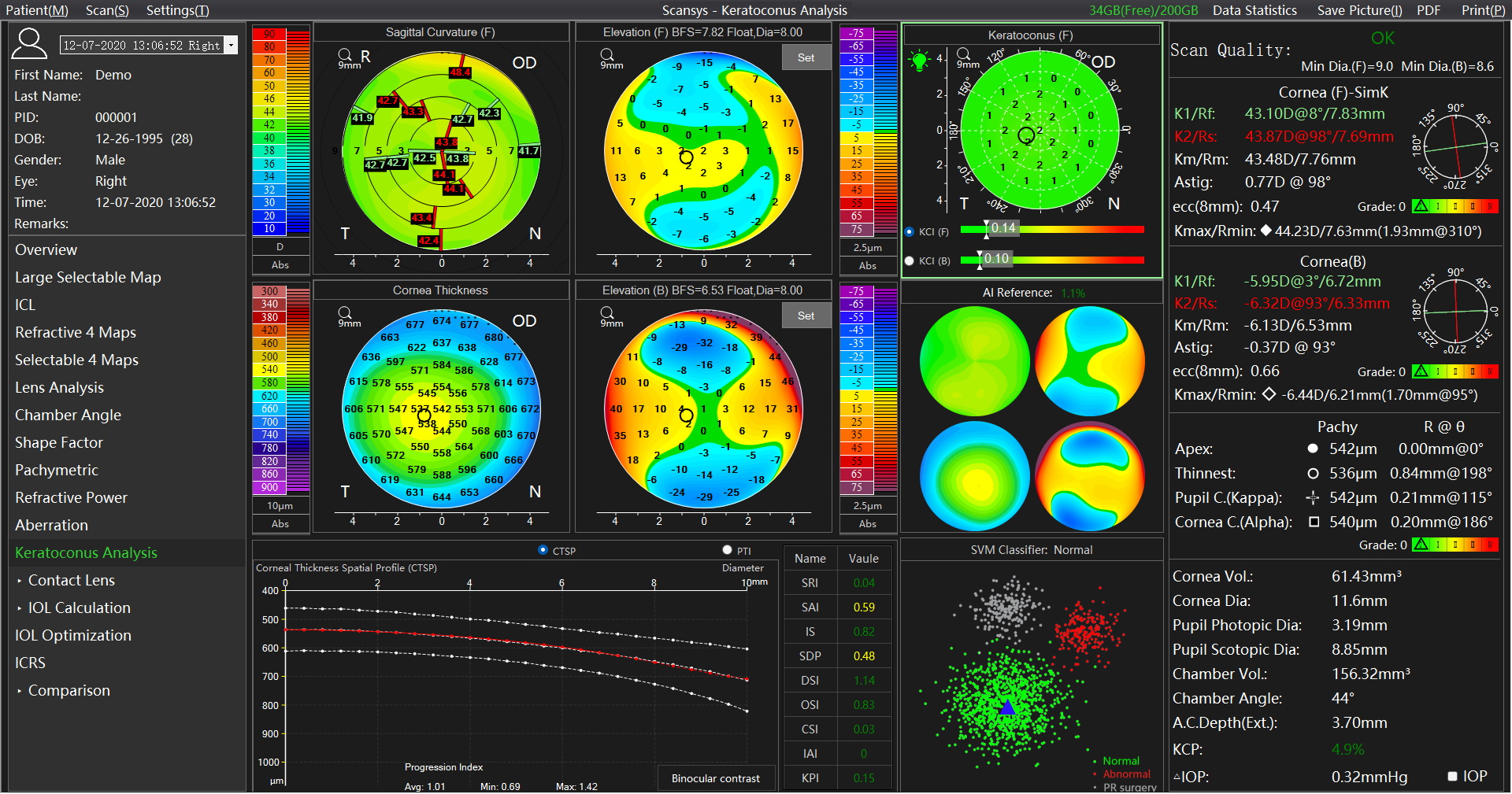 Keratoconus Analysis (2)_看图王.jpg