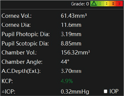 20240517 TA 517 Scansys Anterior Segment Analyzer-13.jpg