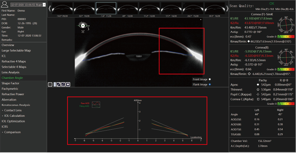 20240517 TA 517 Scansys Anterior Segment Analyzer-18.jpg